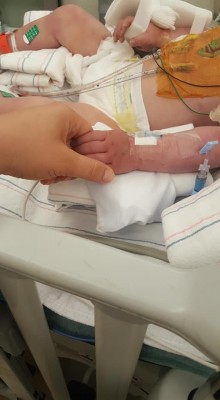 Antoś Kuczyński pomyślnie przeszedł niezwykle skomplikowaną operację serca w Stanach Zjednoczonych