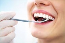 Fakty i mity o wybielaniu zębów