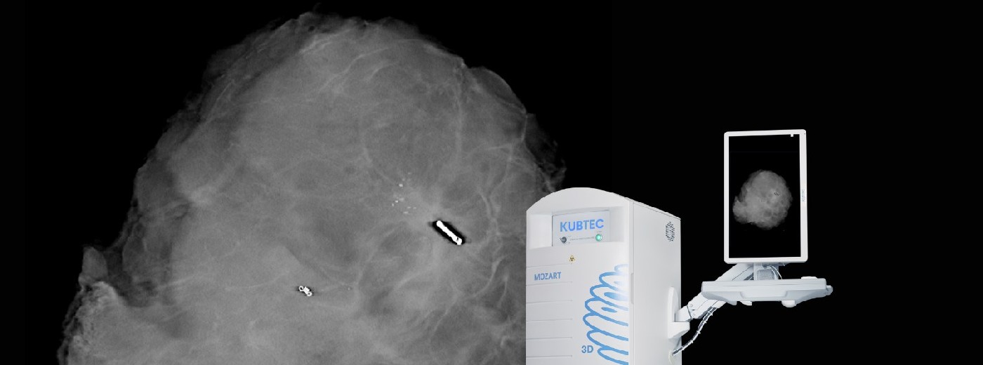 Szpital Wojewódzki w Suwałkach zakupił sprzęt obrazujący 3D wycięte tkanki. Postęp w onkologii